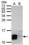 LY6/PLAUR Domain Containing 6 antibody, PA5-32089, Invitrogen Antibodies, Western Blot image 