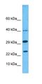 Nudix Hydrolase 1 antibody, orb325449, Biorbyt, Western Blot image 