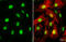 ATRX Chromatin Remodeler antibody, GTX635478, GeneTex, Immunocytochemistry image 