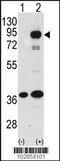 Prospero homeobox protein 1 antibody, TA324702, Origene, Western Blot image 