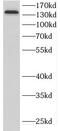 Cell Adhesion Associated, Oncogene Regulated antibody, FNab01567, FineTest, Western Blot image 