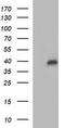 Uracil Phosphoribosyltransferase Homolog antibody, LS-C788333, Lifespan Biosciences, Western Blot image 