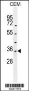 Lactate Dehydrogenase A Like 6A antibody, 55-490, ProSci, Western Blot image 