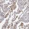 Protein eyes shut homolog antibody, HPA027103, Atlas Antibodies, Immunohistochemistry paraffin image 