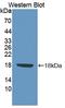 Fibronectin Leucine Rich Transmembrane Protein 3 antibody, LS-C373358, Lifespan Biosciences, Western Blot image 