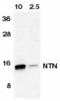Neurturin antibody, TA305946, Origene, Western Blot image 