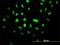 Vacuolar Protein Sorting 25 Homolog antibody, H00084313-M01, Novus Biologicals, Immunofluorescence image 