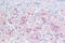 AD4BP antibody, ARP45619_P050, Aviva Systems Biology, Immunohistochemistry paraffin image 