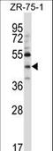 Nex1 antibody, LS-C203683, Lifespan Biosciences, Western Blot image 