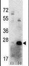 Casein kinase II subunit beta antibody, PA5-13834, Invitrogen Antibodies, Western Blot image 