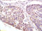 X Antigen Family Member 2 antibody, GTX51780, GeneTex, Immunohistochemistry paraffin image 