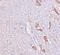 Leucine Rich Repeat Transmembrane Neuronal 1 antibody, A08006, Boster Biological Technology, Immunohistochemistry paraffin image 