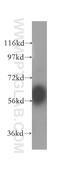 High molecular weight kininogen antibody, 11926-1-AP, Proteintech Group, Western Blot image 