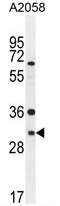 ARV1 Homolog, Fatty Acid Homeostasis Modulator antibody, AP50263PU-N, Origene, Western Blot image 
