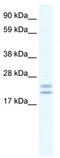 Tubulin Polymerization Promoting Protein antibody, TA331430, Origene, Western Blot image 