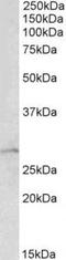 Rho GDP-dissociation inhibitor 1 antibody, TA311290, Origene, Western Blot image 