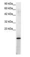 Pc4 antibody, PA1-24480, Invitrogen Antibodies, Western Blot image 
