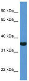 DT-diaphorase antibody, TA343122, Origene, Western Blot image 