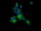 Melan-A antibody, LS-C174643, Lifespan Biosciences, Immunofluorescence image 