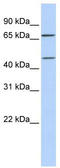 High affinity choline transporter 1 antibody, TA333719, Origene, Western Blot image 