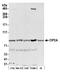 Protein CIP2A antibody, A301-454A, Bethyl Labs, Western Blot image 