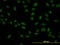 SMAD Family Member 5 antibody, LS-C197637, Lifespan Biosciences, Immunofluorescence image 
