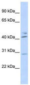 Spi-C Transcription Factor antibody, TA345536, Origene, Western Blot image 