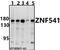 Zinc Finger Protein 541 antibody, A15047-1, Boster Biological Technology, Western Blot image 