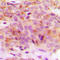 SNCG antibody, LS-C352863, Lifespan Biosciences, Immunohistochemistry paraffin image 