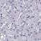 pro-SAAS antibody, NBP2-49423, Novus Biologicals, Immunohistochemistry paraffin image 