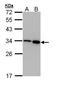 RFA2 antibody, orb74189, Biorbyt, Western Blot image 