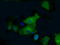 6-Phosphofructo-2-Kinase/Fructose-2,6-Biphosphatase 4 antibody, TA500809, Origene, Immunofluorescence image 