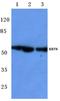 Keratin 8 antibody, AP06205PU-N, Origene, Western Blot image 
