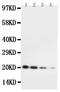 Interleukin 10 antibody, RP1015, Boster Biological Technology, Western Blot image 