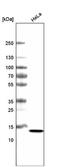 Cancer/Testis Antigen 83 antibody, NBP2-59062, Novus Biologicals, Western Blot image 