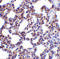 Interferon-induced, double-stranded RNA-activated protein kinase antibody, 3949, ProSci Inc, Immunohistochemistry paraffin image 