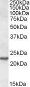 Secretion Associated Ras Related GTPase 1A antibody, TA305682, Origene, Western Blot image 