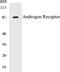 Androgen Receptor antibody, EKC1029, Boster Biological Technology, Western Blot image 