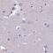 Uroplakin-2 antibody, PA5-60318, Invitrogen Antibodies, Immunohistochemistry paraffin image 