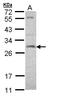 Synaptosome Associated Protein 23 antibody, LS-B4844, Lifespan Biosciences, Western Blot image 