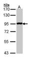Adhesion G Protein-Coupled Receptor G5 antibody, orb74298, Biorbyt, Western Blot image 