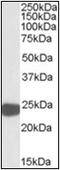 Peroxiredoxin 1 antibody, AP23064PU-N, Origene, Western Blot image 