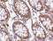 Protein-tyrosine kinase 7 antibody, 4297, ProSci, Immunohistochemistry paraffin image 