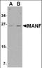 Mesencephalic Astrocyte Derived Neurotrophic Factor antibody, orb88371, Biorbyt, Western Blot image 