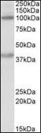 Zinc Finger E-Box Binding Homeobox 2 antibody, orb95804, Biorbyt, Western Blot image 