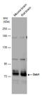 Disabled homolog 1 antibody, GTX133086, GeneTex, Western Blot image 