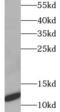 Cancer/Testis Antigen 83 antibody, FNab02112, FineTest, Western Blot image 