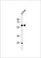 Cytochrome P450 4X1 antibody, PA5-72422, Invitrogen Antibodies, Western Blot image 