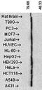 Heat shock 70 kDa protein 1A/1B antibody, orb67306, Biorbyt, Western Blot image 