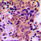 ATF4 antibody, LS-C353911, Lifespan Biosciences, Immunohistochemistry paraffin image 